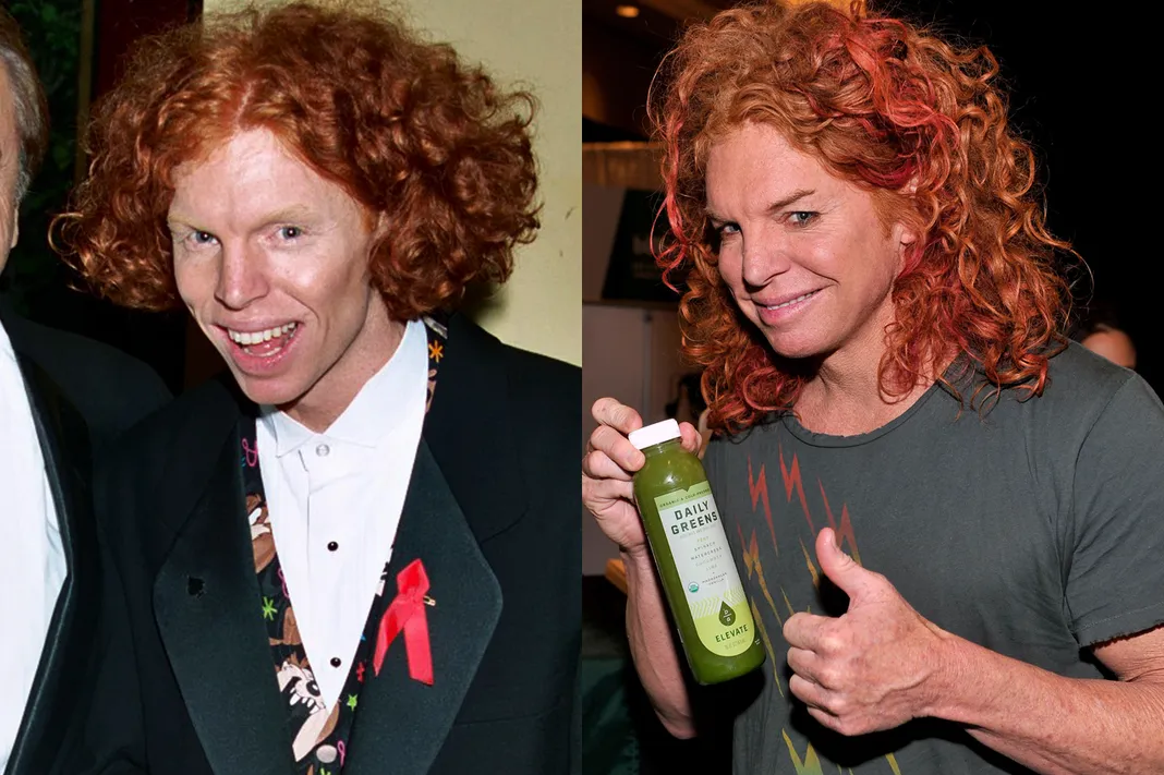 surgery Carrot top facial Shane recommends Free lesbian housewives pics